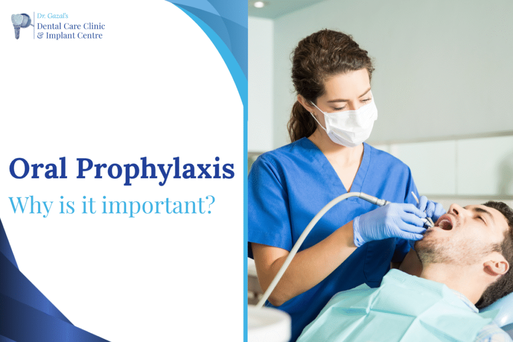 Oral Prophylaxis