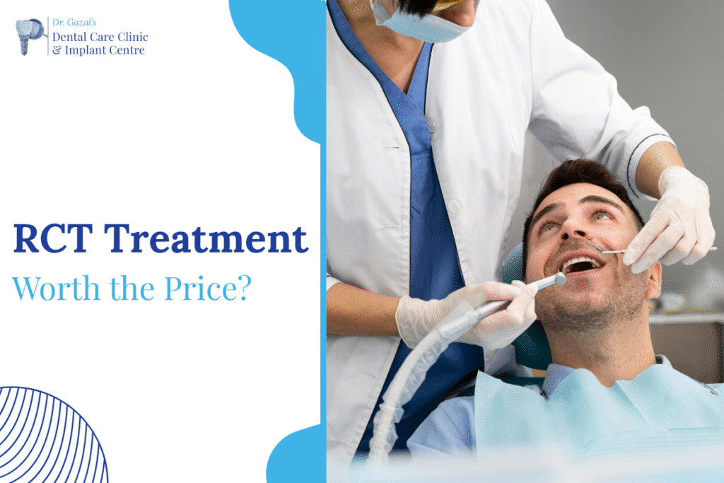 RCT Treatment Cost
